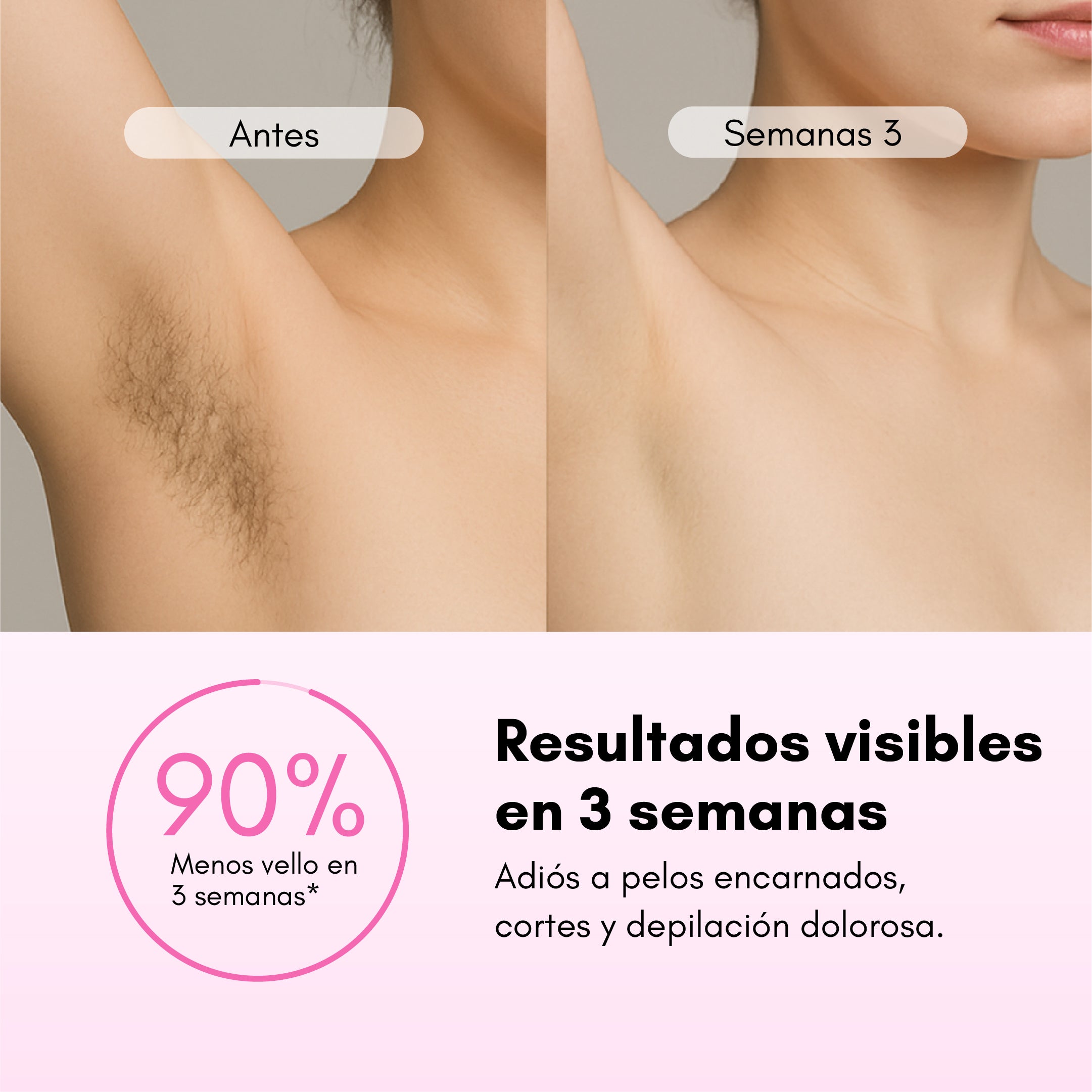 Depiladora Láser RebelSkin™ - Rebel