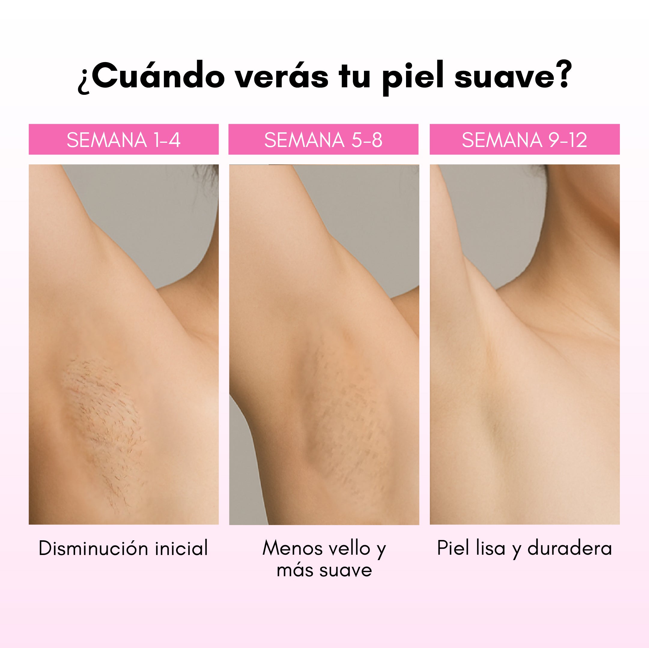 Depiladora Láser RebelSkin™ - Rebel