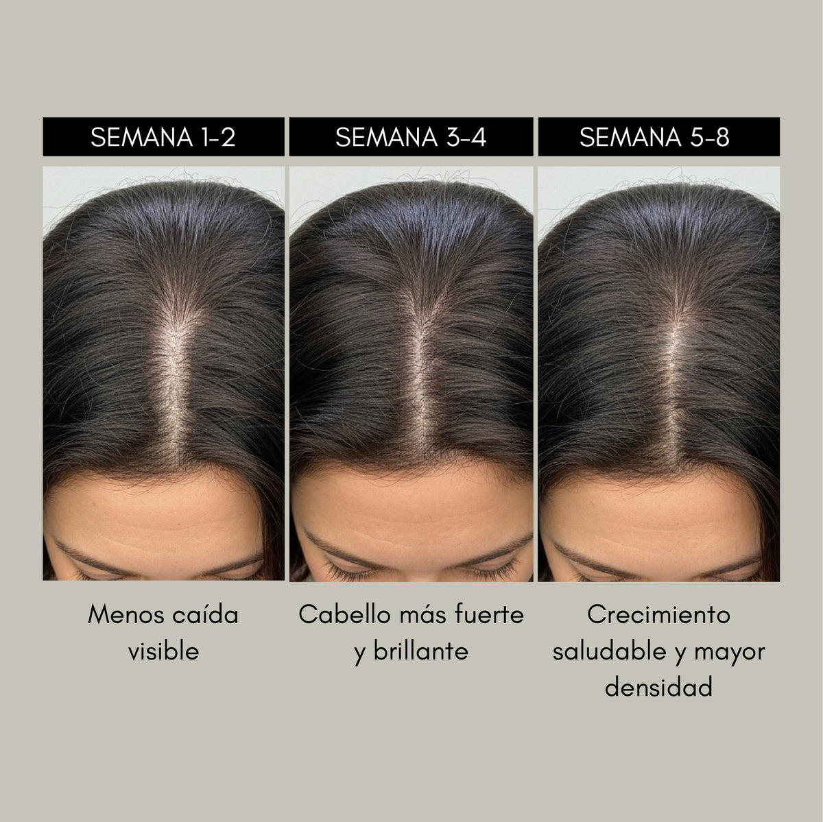 RevitaMAX Estimulador Crecimiento Capilar - Rebel