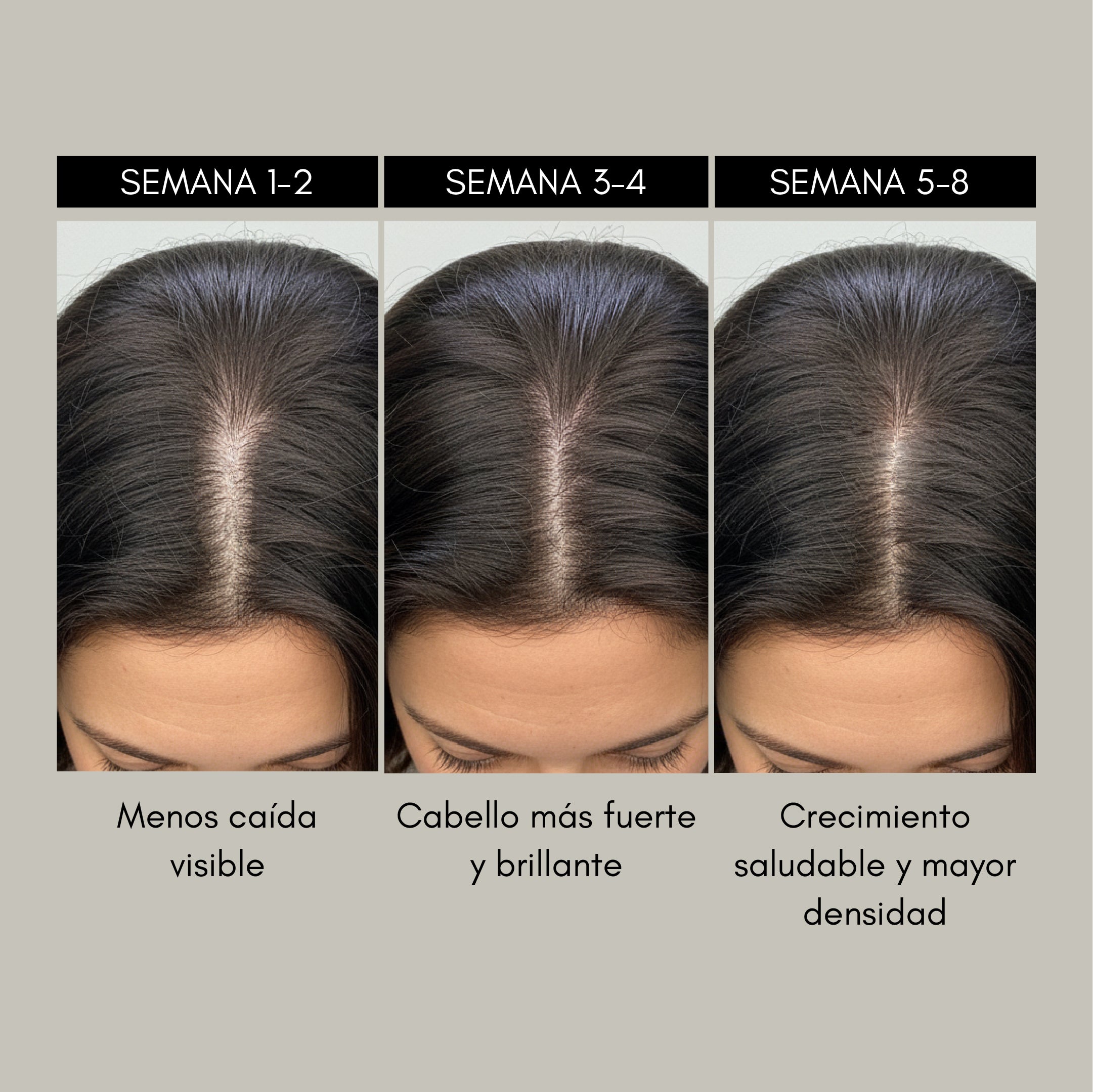 RevitaMAX Estimulador Crecimiento Capilar - Rebel