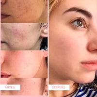 Mascarilla Facial Pink and Clean