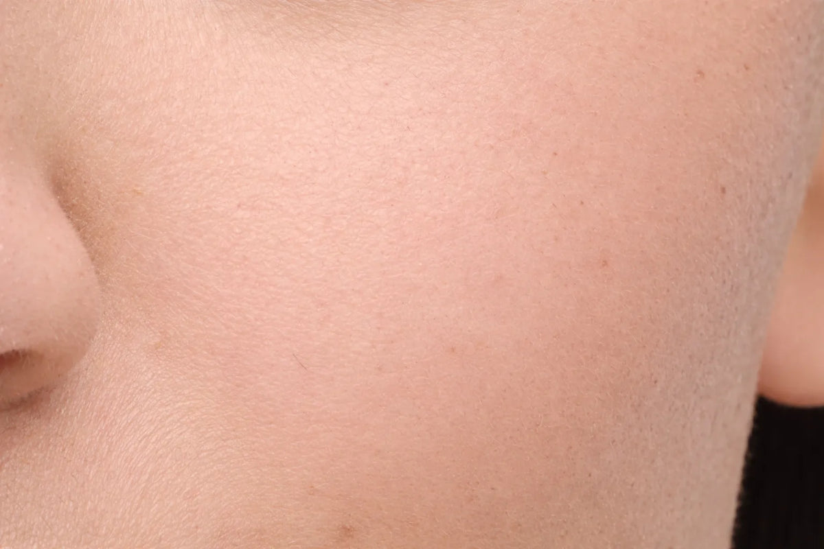 Antes